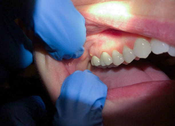 Best Pediatric Emergency Dentist in Lac Du Flambeau, WI